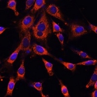 ITPR3 Rabbit Polyclonal Antibody