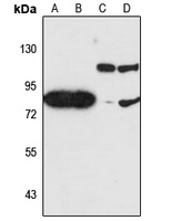 JAKMIP2 Rabbit Polyclonal Antibody