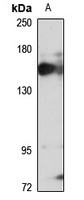 JMJD1A Rabbit Polyclonal Antibody