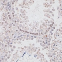 JMJD1A Rabbit Polyclonal Antibody