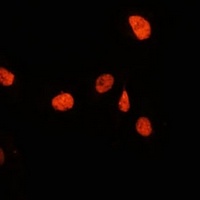 JMJD1A Rabbit Polyclonal Antibody