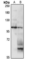 KIAA0319 Rabbit Polyclonal Antibody