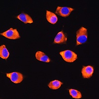 KIF21A Rabbit Polyclonal Antibody
