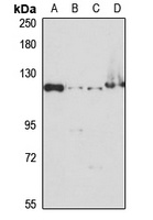 KIF5B Rabbit Polyclonal Antibody