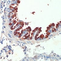 KIF5B Rabbit Polyclonal Antibody
