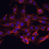 KIF5B Rabbit Polyclonal Antibody