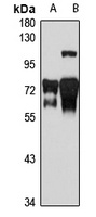 KIFC1 Rabbit Polyclonal Antibody