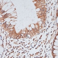 KIFC1 Rabbit Polyclonal Antibody