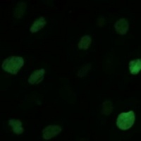 KIFC1 Rabbit Polyclonal Antibody