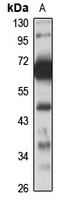 KLF6 Rabbit Polyclonal Antibody