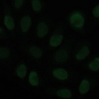 KLF6 Rabbit Polyclonal Antibody