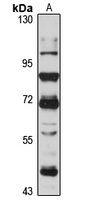 KLHL1 Rabbit Polyclonal Antibody