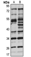 KNSTRN Rabbit Polyclonal Antibody
