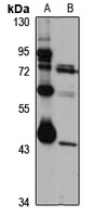 LAX1 Rabbit Polyclonal Antibody