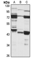 Lefty-2 Rabbit Polyclonal Antibody
