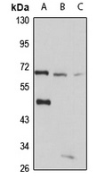 LGI1 Rabbit Polyclonal Antibody