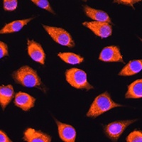 LMBRD1 Rabbit Polyclonal Antibody