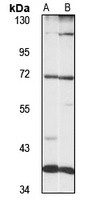 LRRFIP1 Rabbit Polyclonal Antibody