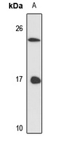 LSm3 Rabbit Polyclonal Antibody