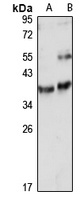 LYPD3 Rabbit Polyclonal Antibody