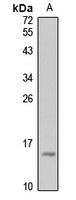 ARMET Rabbit Polyclonal Antibody