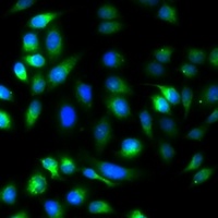 ARMET Rabbit Polyclonal Antibody