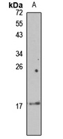 ARMET Rabbit Polyclonal Antibody