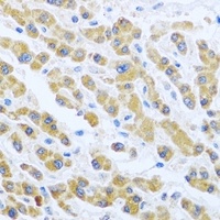 ARMET Rabbit Polyclonal Antibody