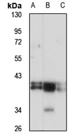 ERK1/2 Rabbit Polyclonal Antibody