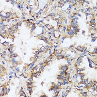 ERK1/2 Rabbit Polyclonal Antibody