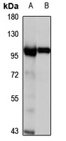 MGAT5 Rabbit Polyclonal Antibody