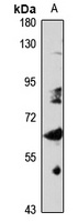 MON1B Rabbit Polyclonal Antibody