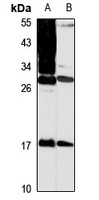 MPZL1 Rabbit Polyclonal Antibody