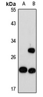 MRPS26 Rabbit Polyclonal Antibody