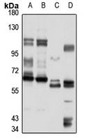 MSH5 Rabbit Polyclonal Antibody