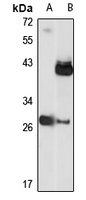 COX3 Rabbit Polyclonal Antibody