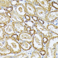 COX3 Rabbit Polyclonal Antibody