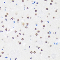 MYEF2 Rabbit Polyclonal Antibody
