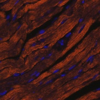 Myosin 6 Rabbit Polyclonal Antibody