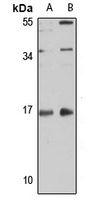 MYL12A Rabbit Polyclonal Antibody