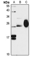 MYL4 Rabbit Polyclonal Antibody
