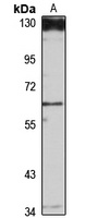 MLCK2 Rabbit Polyclonal Antibody
