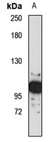 NAV2 Rabbit Polyclonal Antibody