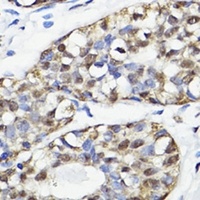 NAV2 Rabbit Polyclonal Antibody