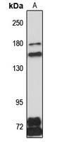 NHS Rabbit Polyclonal Antibody