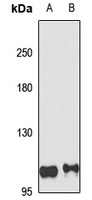 NLRP7 Rabbit Polyclonal Antibody
