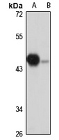 NOB1 Rabbit Polyclonal Antibody