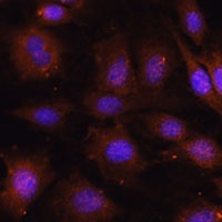 NOB1 Rabbit Polyclonal Antibody