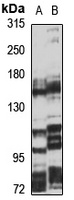 NPC1L1 Rabbit Polyclonal Antibody