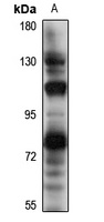 NPR2 Rabbit Polyclonal Antibody